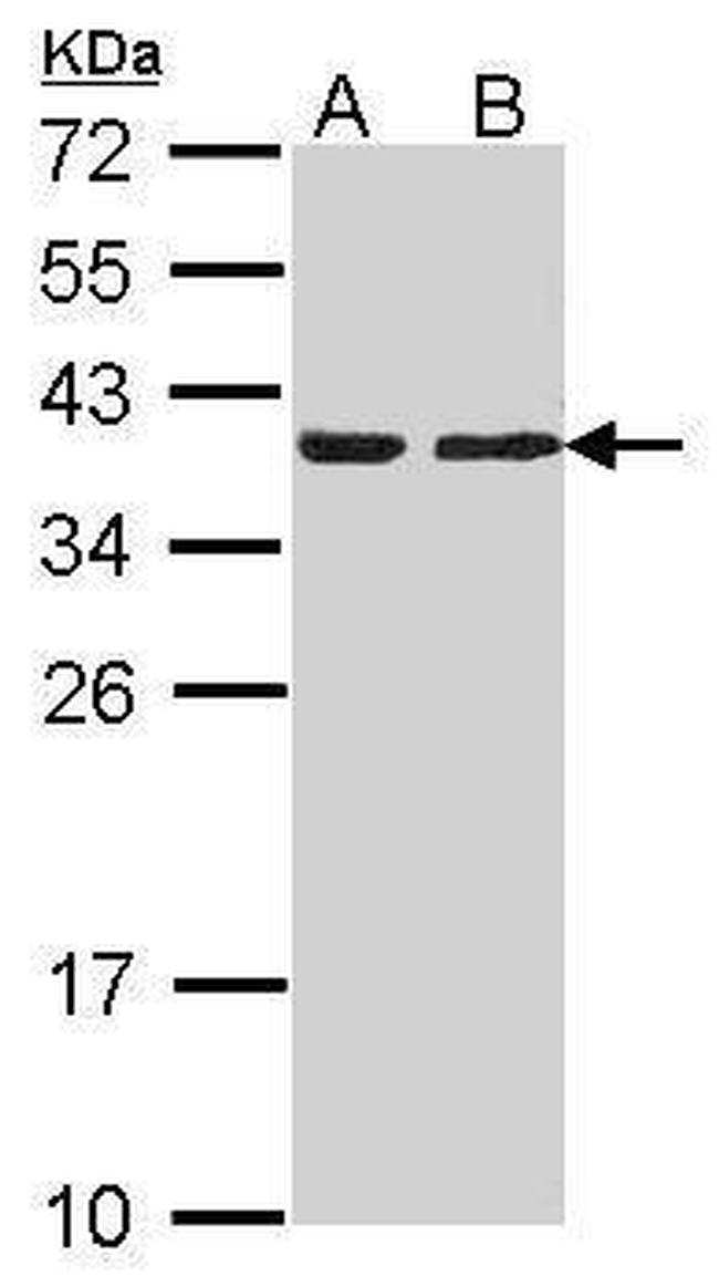 CAPZA2 Antibody in Western Blot (WB)