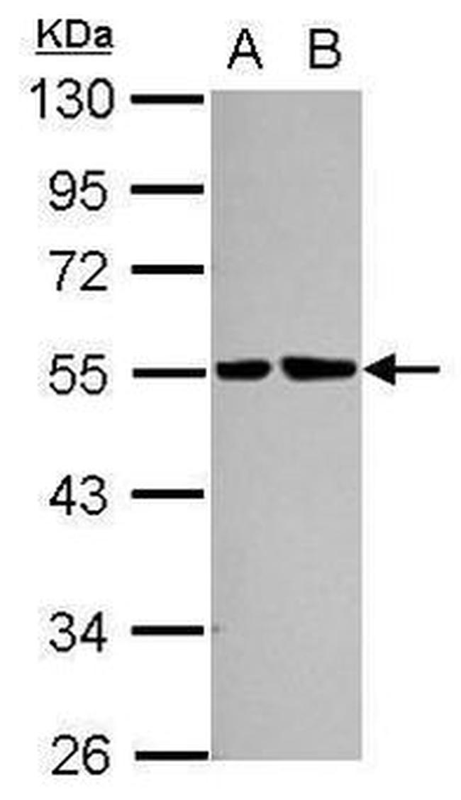 LIMP2 Antibody in Western Blot (WB)