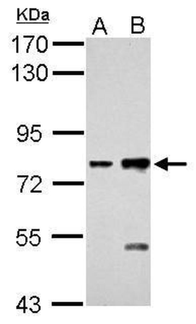 K-cadherin Antibody in Western Blot (WB)