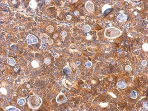 CHI3L2 Antibody in Immunohistochemistry (Paraffin) (IHC (P))
