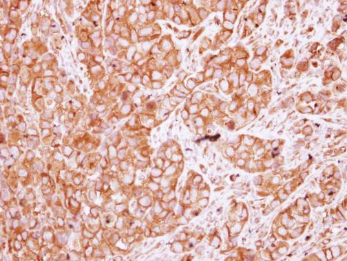 CHRNB1 Antibody in Immunohistochemistry (Paraffin) (IHC (P))