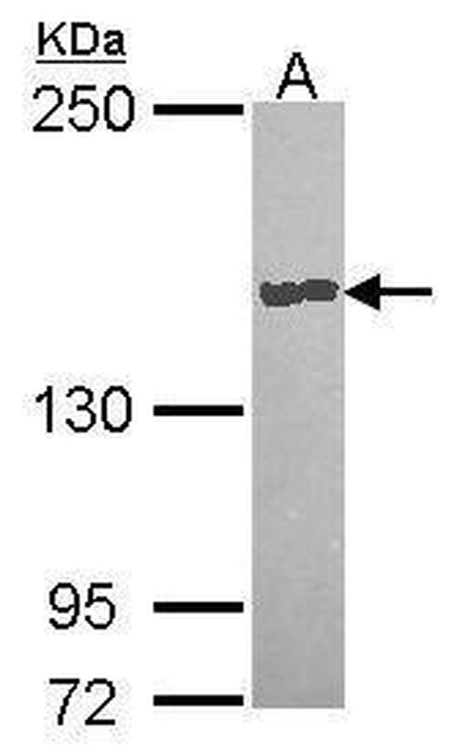 Carboxypeptidase D Antibody in Western Blot (WB)