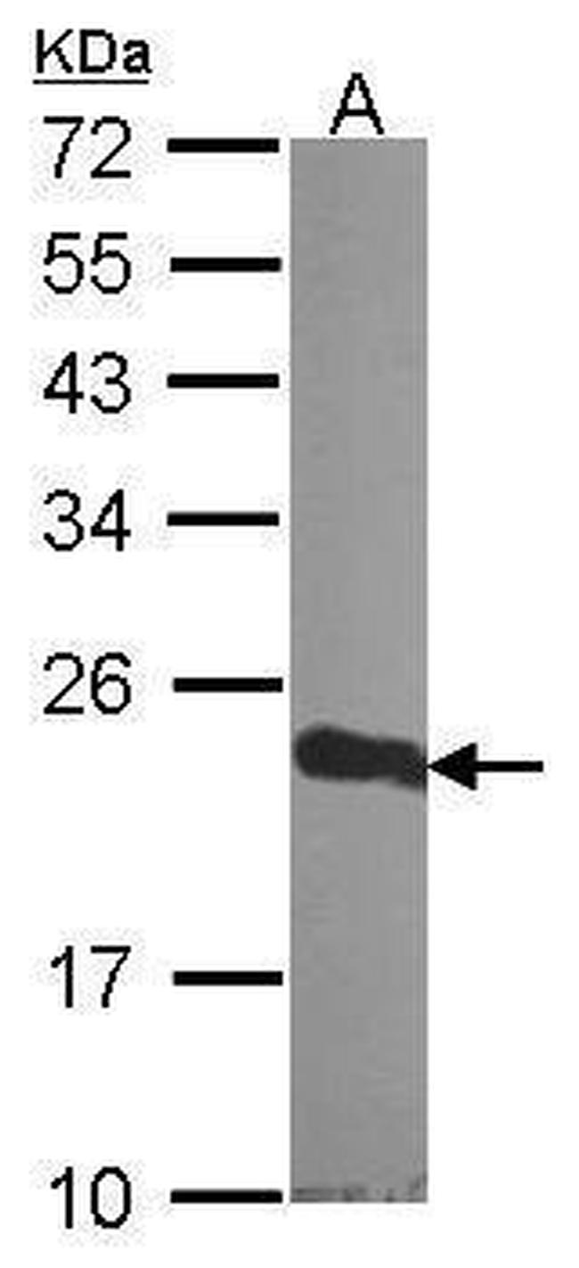 CRP1 Antibody in Western Blot (WB)