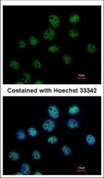 CSTF1 Antibody in Immunocytochemistry (ICC/IF)