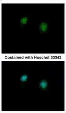 CtBP2 Antibody in Immunocytochemistry (ICC/IF)