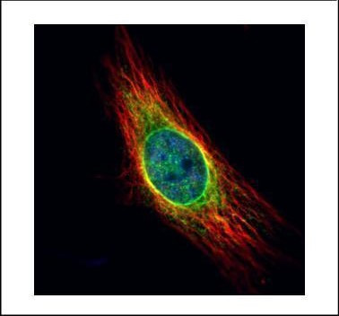 Cathepsin S Antibody in Immunocytochemistry (ICC/IF)