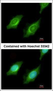 CYP4A11 Antibody in Immunocytochemistry (ICC/IF)