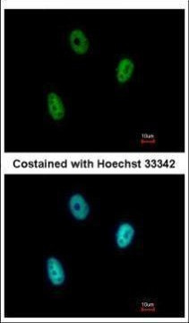 E2F6 Antibody in Immunocytochemistry (ICC/IF)