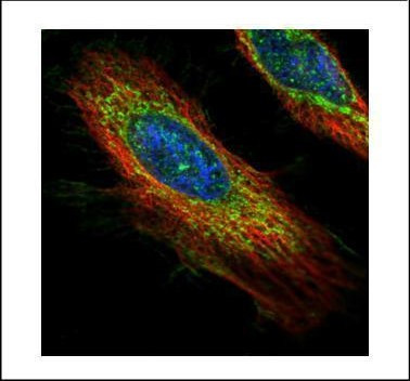 ECH1 Antibody in Immunocytochemistry (ICC/IF)
