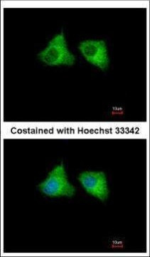 EML1 Antibody in Immunocytochemistry (ICC/IF)