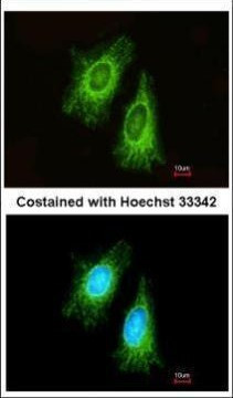 ETFA Antibody in Immunocytochemistry (ICC/IF)