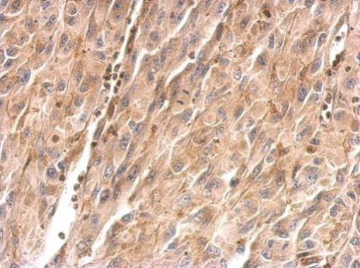 FGL1 Antibody in Immunohistochemistry (Paraffin) (IHC (P))