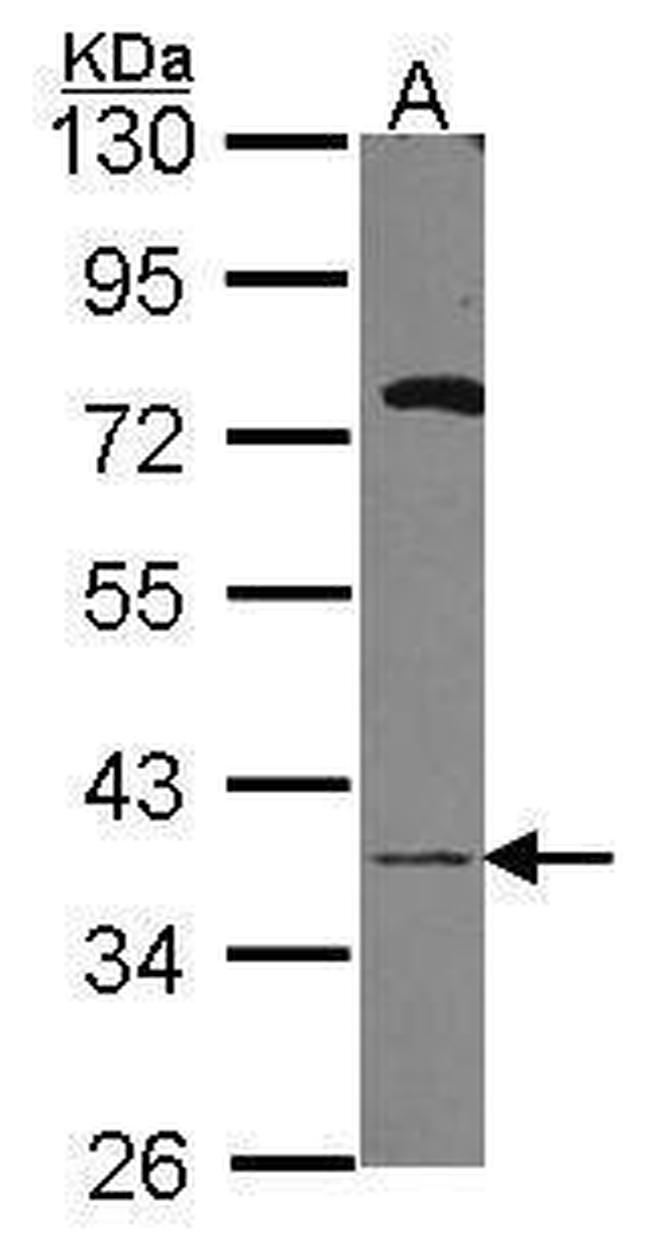 GALE Antibody in Western Blot (WB)