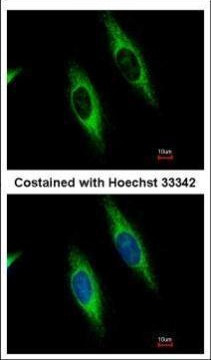 GART Antibody in Immunocytochemistry (ICC/IF)