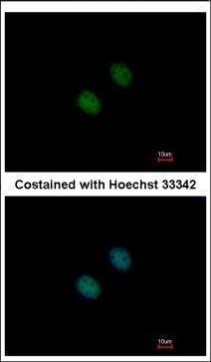 GCN5 Antibody in Immunocytochemistry (ICC/IF)