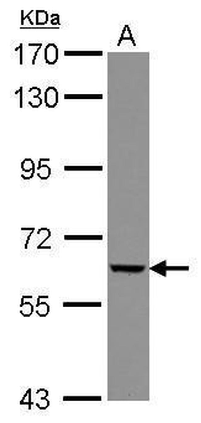 GGT5 Antibody in Western Blot (WB)