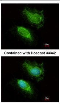 HIP2 Antibody in Immunocytochemistry (ICC/IF)