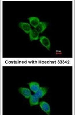IDH1 Antibody in Immunocytochemistry (ICC/IF)