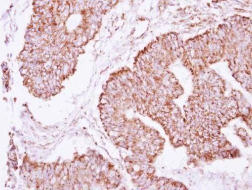 IDH2 Antibody in Immunohistochemistry (Paraffin) (IHC (P))