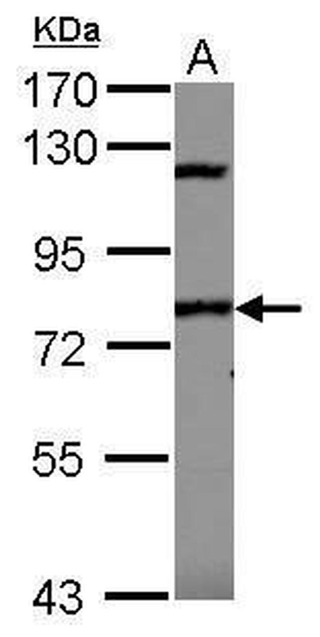 SP110 Antibody in Western Blot (WB)