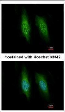 KIFC3 Antibody in Immunocytochemistry (ICC/IF)