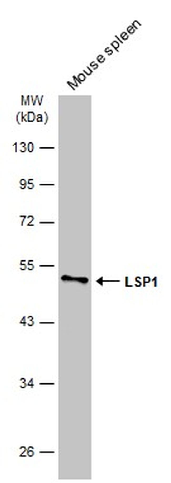 LSP1 Antibody in Western Blot (WB)