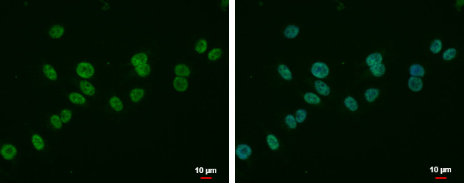MLLT6 Antibody in Immunocytochemistry (ICC/IF)
