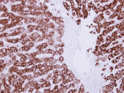 ALDH6A1 Antibody in Immunohistochemistry (Paraffin) (IHC (P))