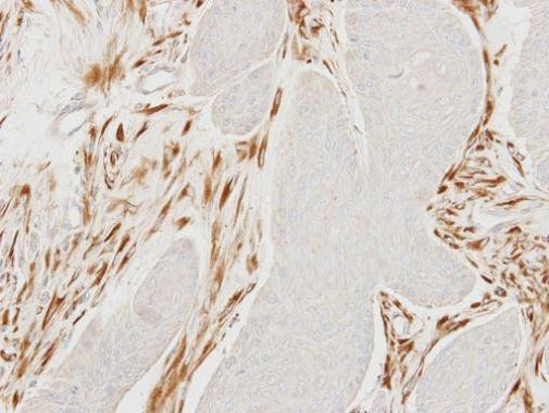 MOCS2 Antibody in Immunohistochemistry (Paraffin) (IHC (P))