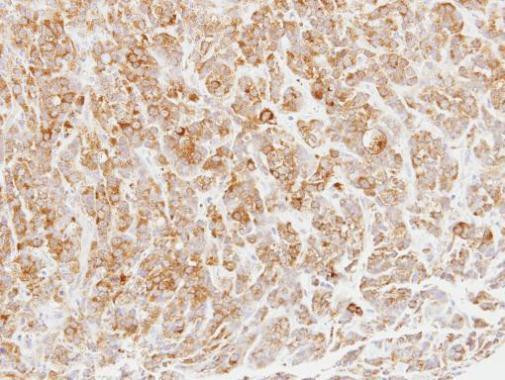 MPI Antibody in Immunohistochemistry (Paraffin) (IHC (P))
