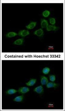 NDUFB10 Antibody in Immunocytochemistry (ICC/IF)