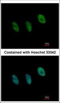 NFYB Antibody in Immunocytochemistry (ICC/IF)