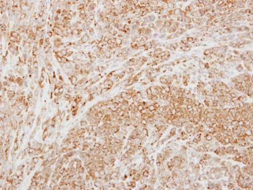 NPTX2 Antibody in Immunohistochemistry (Paraffin) (IHC (P))