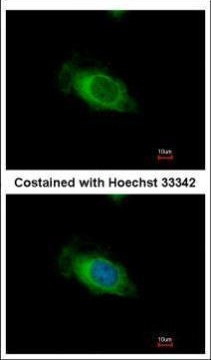 Nardilysin Antibody in Immunocytochemistry (ICC/IF)