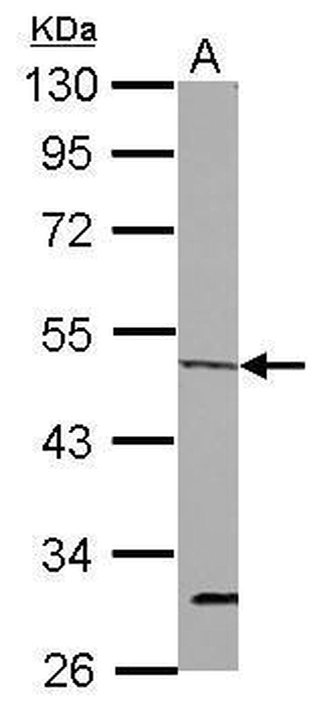 ORC4 Antibody in Western Blot (WB)