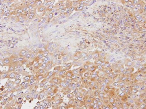 OSBP Antibody in Immunohistochemistry (Paraffin) (IHC (P))