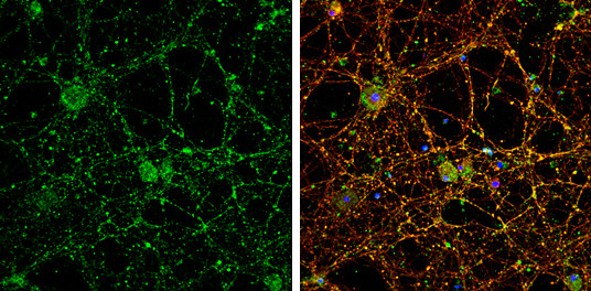 P2Y2 Antibody in Immunocytochemistry (ICC/IF)
