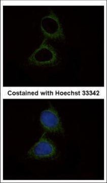 SERPINB6 Antibody in Immunocytochemistry (ICC/IF)