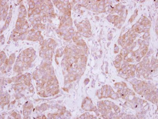 PPEF1 Antibody in Immunohistochemistry (Paraffin) (IHC (P))