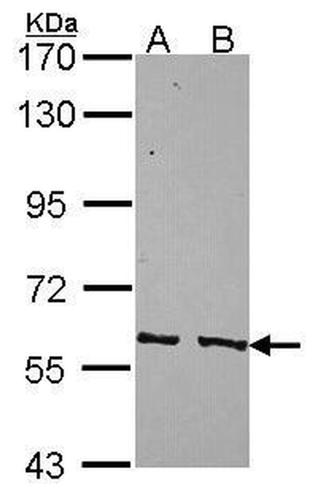PPP3CC Antibody in Western Blot (WB)