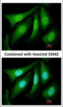 PSMC5 Antibody in Immunocytochemistry (ICC/IF)