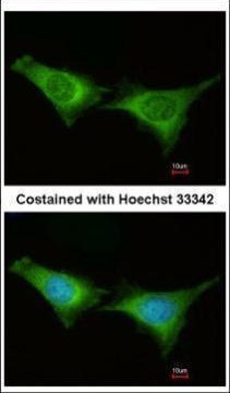 PSMC6 Antibody in Immunocytochemistry (ICC/IF)