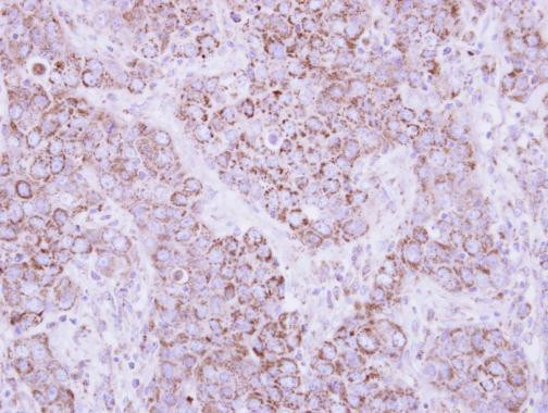 PSMD12 Antibody in Immunohistochemistry (Paraffin) (IHC (P))