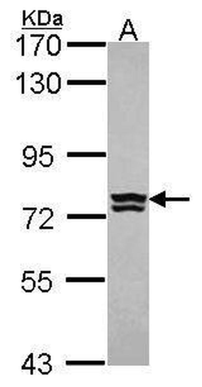 RNPEP Antibody in Western Blot (WB)