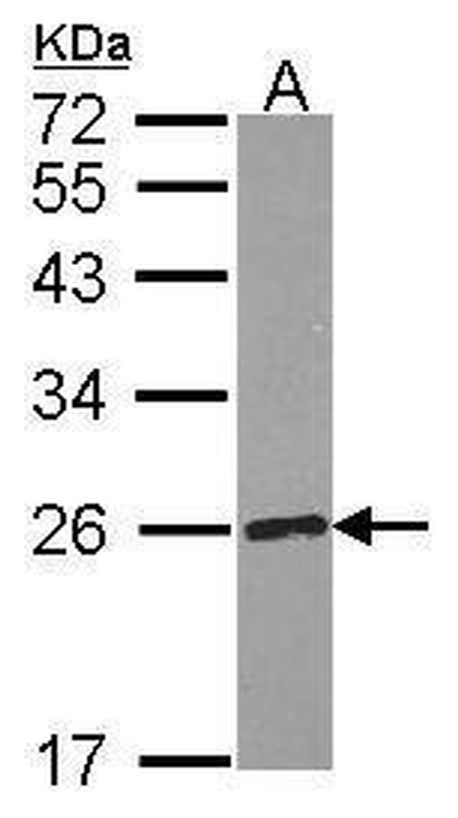 Ribulose-phosphate 3-epimerase Antibody in Western Blot (WB)