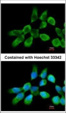 RPL3 Antibody in Immunocytochemistry (ICC/IF)