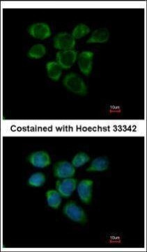 RPL7A Antibody in Immunocytochemistry (ICC/IF)