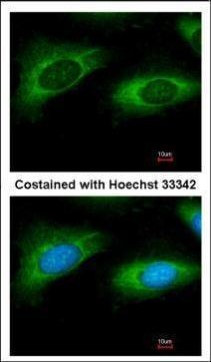 RPL9 Antibody in Immunocytochemistry (ICC/IF)