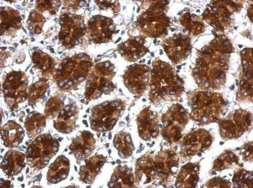 RPLP0 Antibody in Immunohistochemistry (Paraffin) (IHC (P))