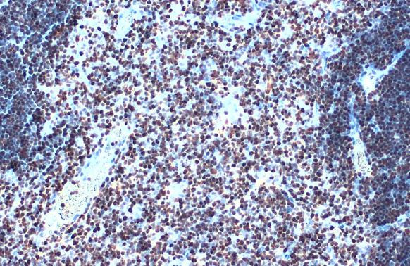 SATB1 Antibody in Immunohistochemistry (Paraffin) (IHC (P))